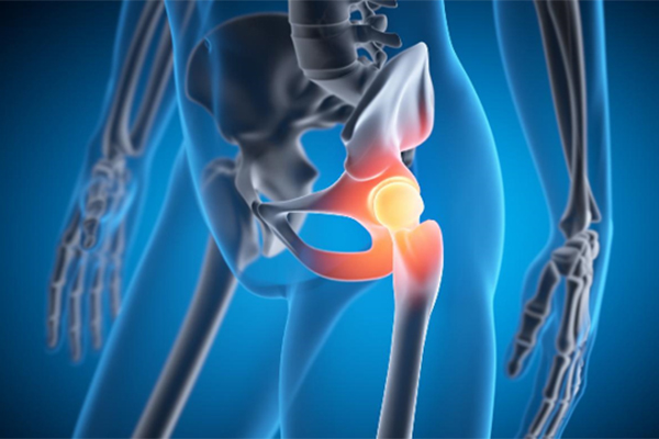Comparing Direct Anterior and Posterior Hip Replacement: Where Robotic Assistance Fits In