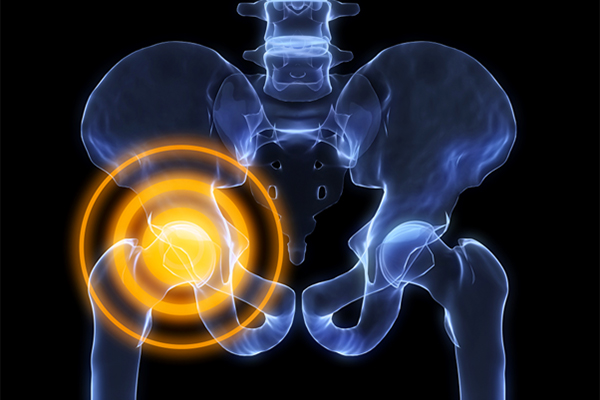 From Imaging to Implant: How Robotic Planning Improves Hip Replacement Precision